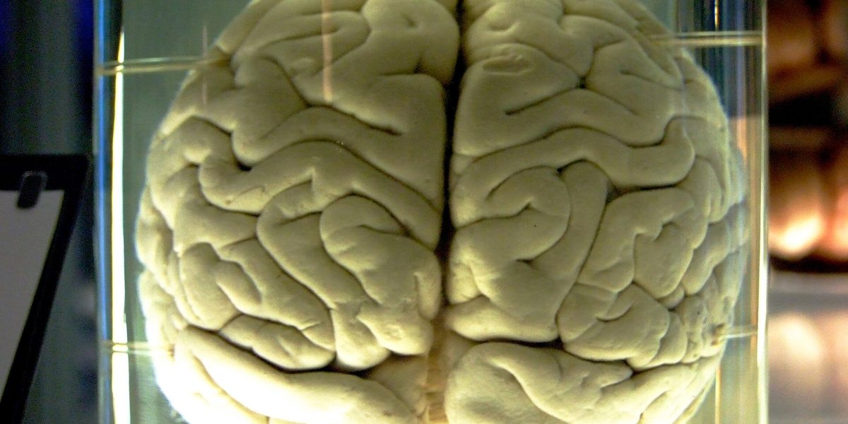 Brain health — brain