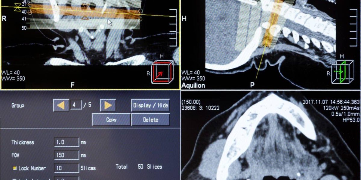 Concussion testing — head injury